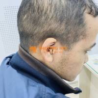 Nghe kém ở người trẻ tuổi, đừng chủ quan!