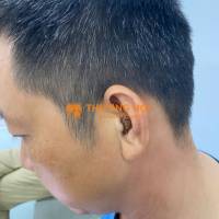 Máy trợ thính trong tai bí mật dành cho người trẻ tuổi