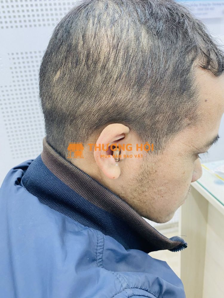 Nghe kém ở người trẻ tuổi, đừng chủ quan!